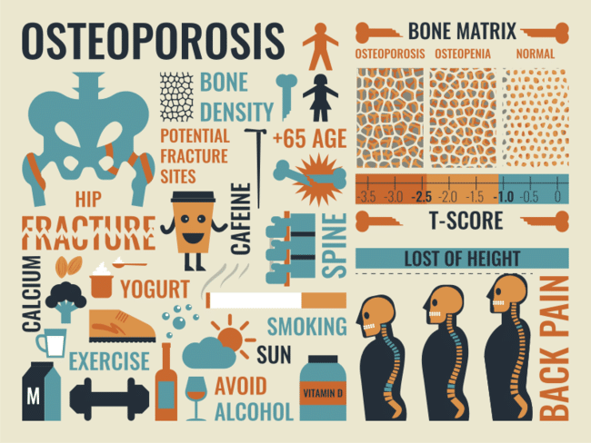 osteoporosis