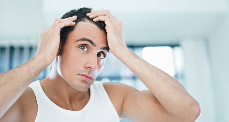 Trasplante capilar con la técnica FUE