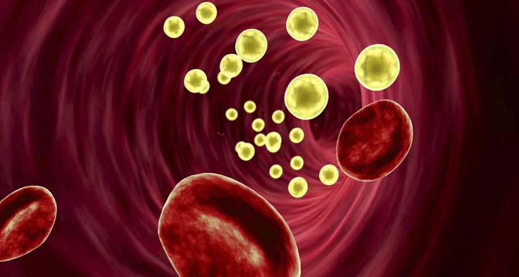 Los tópicos sobre las grasas