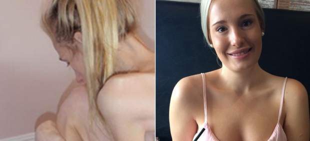 «Así vencí a la anorexia»