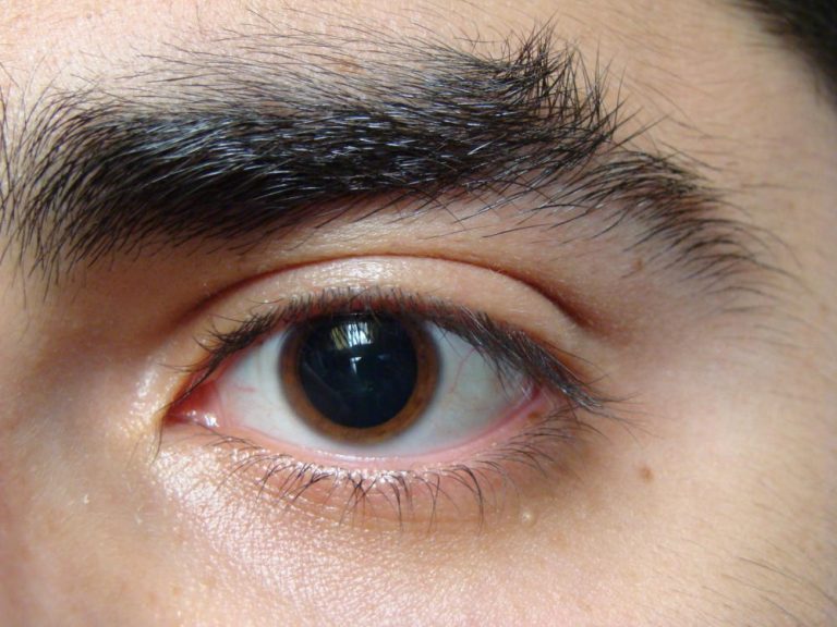 Las cejas, en su sitio