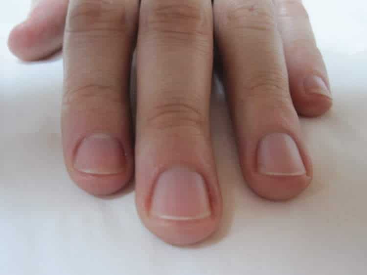 cuidado de las manos