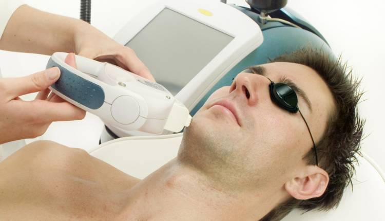 depilación láser masculina