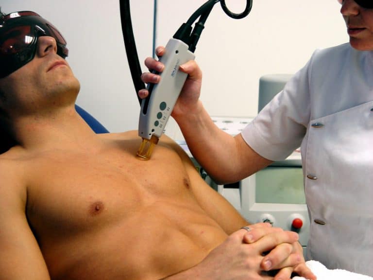 ¿Cuáles son los beneficios de la depilación láser masculina?