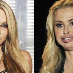 Anastacia