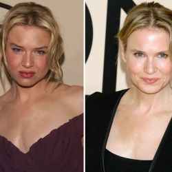 Renée Zellweger